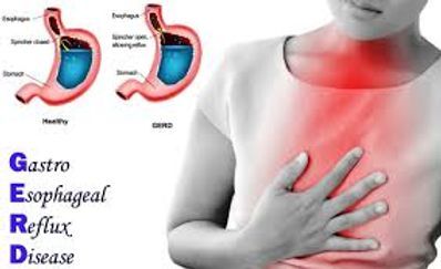 relux acidite gastriaue.jpg
