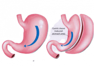 sleeve tanger maroc bruxelles